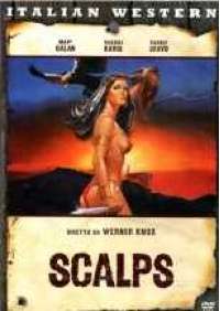 Scalps 